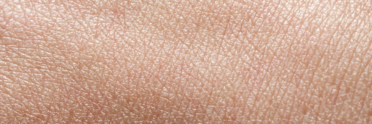 image d'une peau claire seche et deshydratee