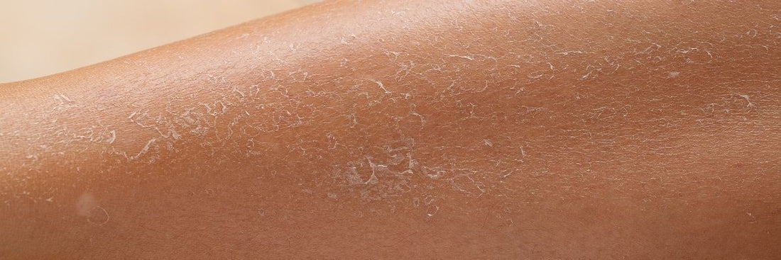 peau d'une jambe tres seche
