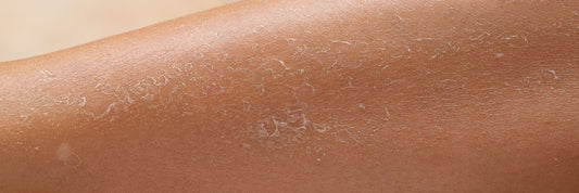 peau d'une jambe tres seche
