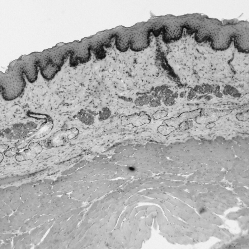 Coupe histologie du derme en noir et blanc vue par microscope. Les différentes couches du derme sont visibles.