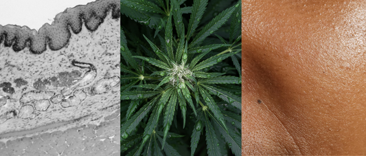 Three-part composite image: on the left, a detailed black-and-white histological slide of skin tissue with hair follicles; in the center, a close-up of a hemp plant with leaves and flower; on the right, a textured close-up of human skin.