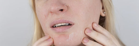 Ma peau du visage pèle : que faire (et comment la sauver) ?